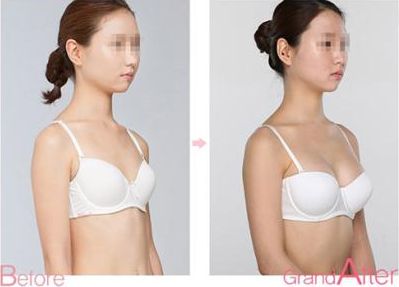 成都祛斑醫(yī)院排名前八，告訴你哪家靠譜