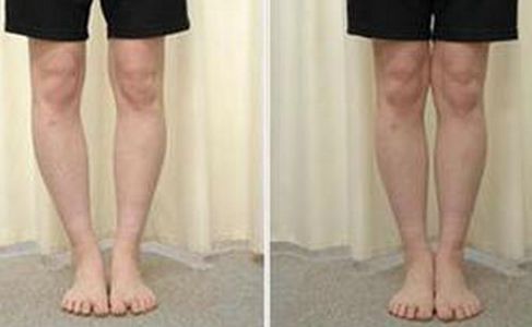 如何使用蜂蜜進(jìn)行減肥？有效嗎？