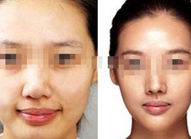 女星蠟像面容成災(zāi)，孫菲菲領(lǐng)銜瘦臉狂潮