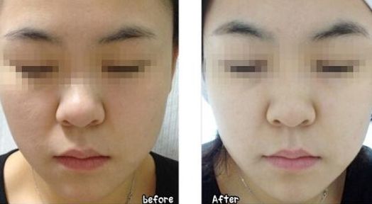 合肥哪些整形醫(yī)院名氣最大？