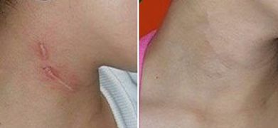 荊門一流整形醫(yī)院，讓你重獲美麗自信