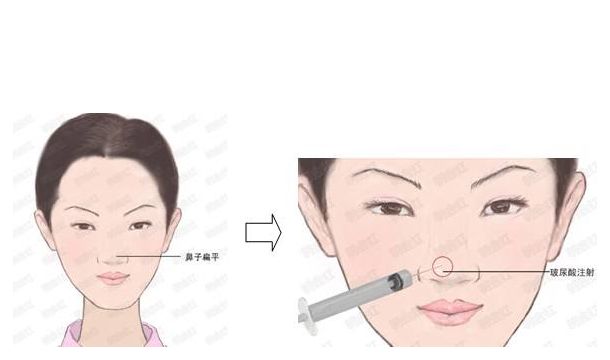 邯鄲萊媚儷整形：價(jià)格實(shí)惠，專業(yè)修復(fù)，雙眼皮、隆鼻等項(xiàng)目詳解！