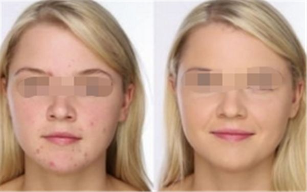 額頭飽滿與個人命運：科學解讀面相學說