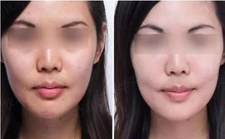 蚌埠最優(yōu)選！第一人民醫(yī)院整形科醫(yī)生名單公開，四月價格表持續(xù)更新！