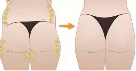 北京雙眼皮價格大全，口碑醫(yī)生推薦，預(yù)約指南