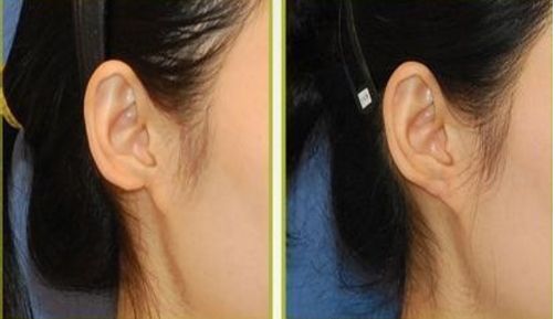 大慶拉皮手術(shù)好口碑醫(yī)院推薦：用戶真實評價分享！