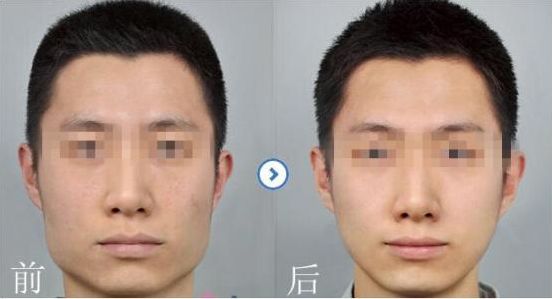 2024寧波注射自體脂肪醫(yī)院排行榜，就在這里發(fā)現(xiàn)比較好的選擇！