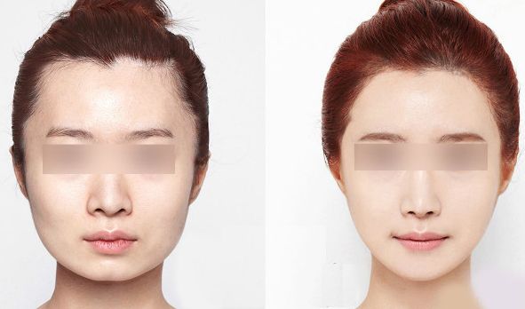 西安藝星醫(yī)療美容醫(yī)院2023年價格一覽：了解醫(yī)療美容服務(wù)費(fèi)用信息，醫(yī)生簡介待查！