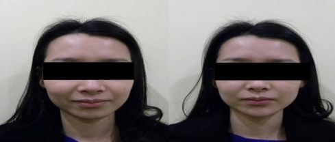 優(yōu)質(zhì)整形醫(yī)院排行榜，找哪家吸脂效果好？