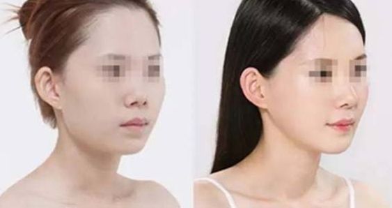 解答：重塑青春，重?zé)ㄈ蓊?！上海時(shí)光整形外科醫(yī)院，專業(yè)修復(fù)美麗，為您點(diǎn)亮自信！