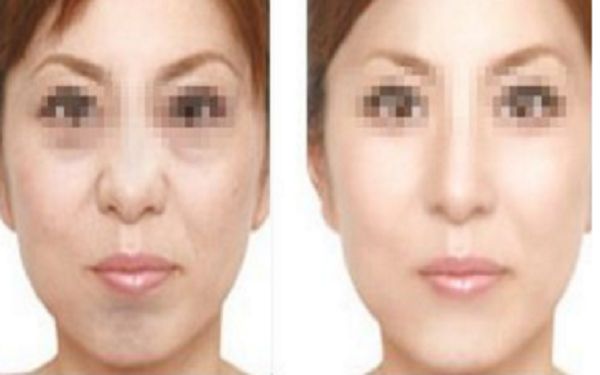 惠州整容醫(yī)院評(píng)價(jià)top10