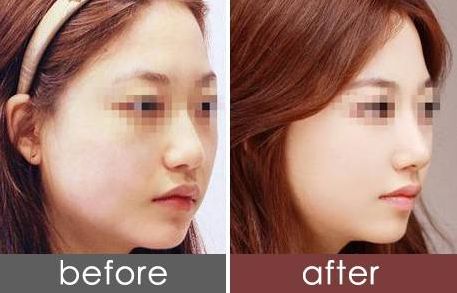 貴陽美萊黃金元美膚三周年特惠：特價(jià)套餐￥8800元！