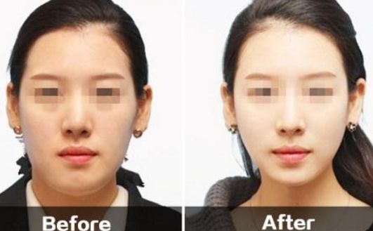 福州名韓和華美對(duì)比：口碑、項(xiàng)目一覽