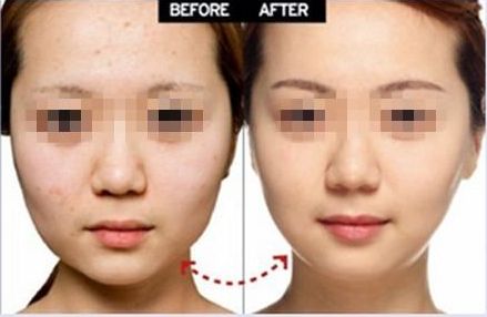 上海眼部整形醫(yī)院推薦，雙眼皮修復(fù)效果好