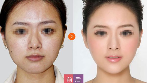 邢臺博愛高健整容致命嗎？高健整容水平值得信賴！