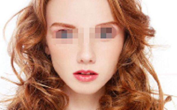 衢州哪家醫(yī)院割雙眼皮效果好？