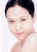 重慶面部脂肪填充專(zhuān)家資深推薦