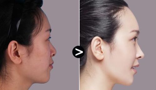 西安哪家整形醫(yī)院匯總排名前十？專業(yè)權(quán)威醫(yī)院推薦！