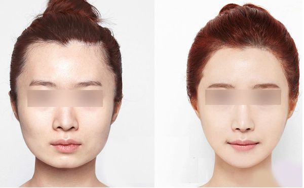 深圳有哪些專業(yè)整形醫(yī)院值得推薦？