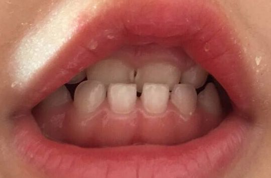 鄭州瑞顏會(huì)整形醫(yī)院，誠(chéng)信專業(yè)值得信賴