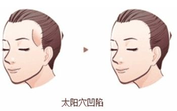 成都整形醫(yī)院排名前十名單整理，銅雀臺、米蘭柏羽何居首？