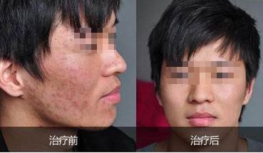 酒泉維爾麗整形醫(yī)院醫(yī)生團(tuán)隊(duì)精湛技藝，專業(yè)特色項(xiàng)目讓您心動！