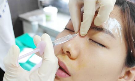 【最新】西安雙眼皮醫(yī)院推薦專(zhuān)家名單公布