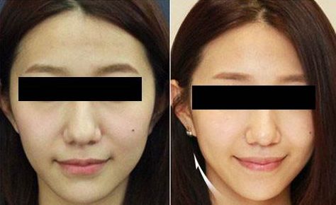 臨沂市哪家整形美容醫(yī)院口碑比較好？