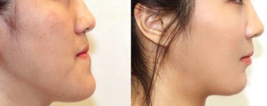 重慶軍科整形美容醫(yī)院口碑如何？醫(yī)生技術看評價，了解綜合實力！