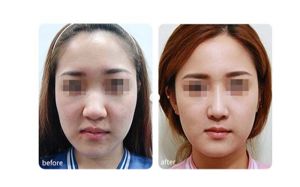 廣州優(yōu)質(zhì)磨骨整形醫(yī)院推薦！TOP10醫(yī)療機(jī)構(gòu)揭秘