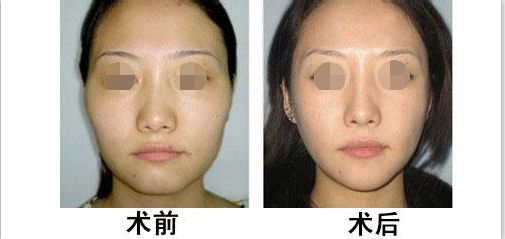 蘭州有哪些專業(yè)整形醫(yī)院值得去？