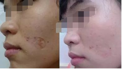 無錫哪家醫(yī)院的美容效果好