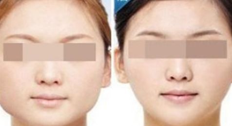 2024大連哪家醫(yī)院吸脂效果最好？這里有前十名匯總！