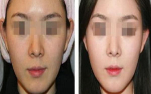 銅陵博愛醫(yī)院醫(yī)療美容科，專業(yè)醫(yī)生技術(shù)如何？