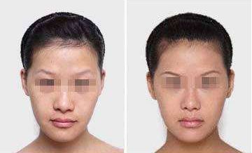 沙醫(yī)生整形大連收費(fèi)揭秘！院內(nèi)價(jià)格表詳解，看看整形費(fèi)用是否貴？