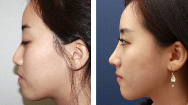 廈門整形醫(yī)院綜合排行榜單 top10，好評如潮！