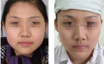 天津比較好的磨骨醫(yī)院排行榜