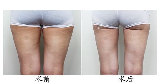 福州七家正規(guī)整形醫(yī)院綜合排名推薦