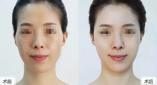 2024成都哪家醫(yī)院做私密整形好