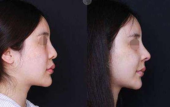 大連最佳整形美容醫(yī)院評(píng)選結(jié)果公布