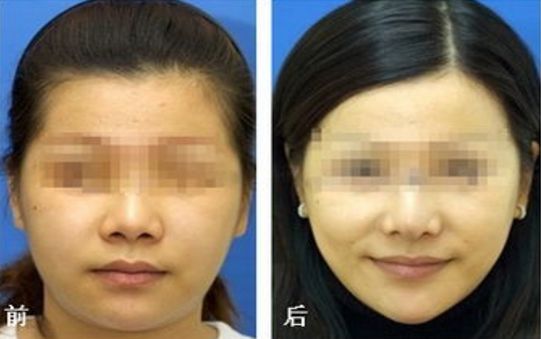 廣東美恩整形美容醫(yī)院口碑揭秘：地址、醫(yī)生評價指南