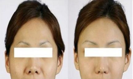 寧波美容整形診所評鑒及優(yōu)質(zhì)推薦