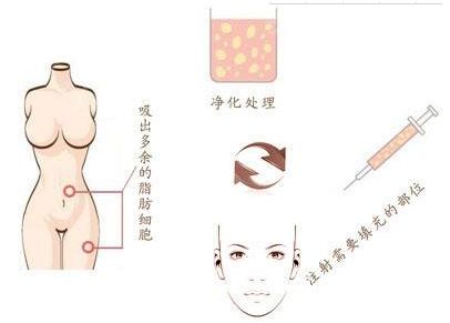 南通鼻整形實(shí)力強(qiáng)勁醫(yī)院盤點(diǎn)：專業(yè)醫(yī)師，打造精致鼻型