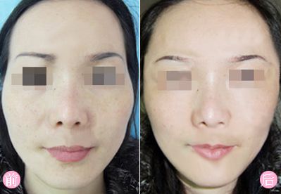 青島金泰諾整形診所最新報價單和醫(yī)生評價公布！