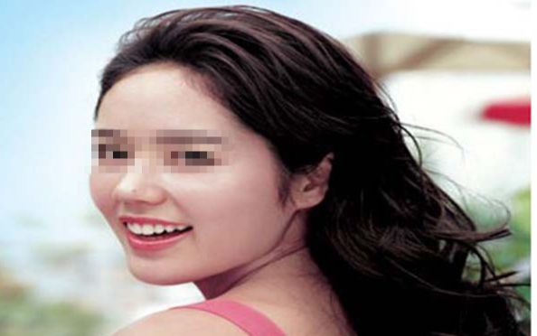 烏魯木齊哪家整形醫(yī)院的口碑比較好？