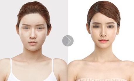 北京植發(fā)醫(yī)院推薦，哪家效果好？