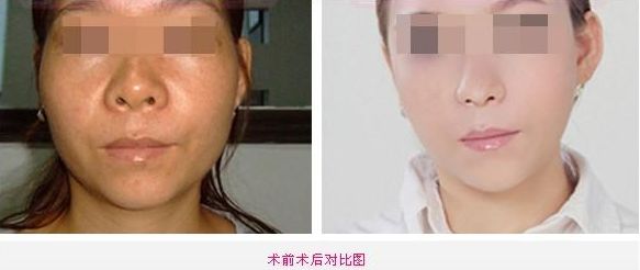 全新整容醫(yī)院推薦！這5家值得你關(guān)注