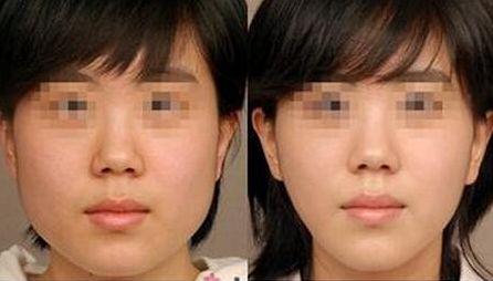 上海醫(yī)美三強競爭激烈！公立九院實力領跑