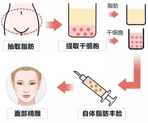 上海最佳雙眼皮整形醫(yī)生推薦及價格列表