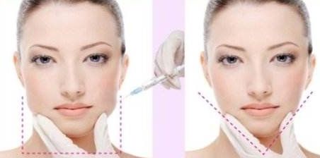 2024年成都哪家正畸醫(yī)院口碑好？?jī)r(jià)格查詢(xún)澤西醫(yī)生正畸美團(tuán)優(yōu)惠